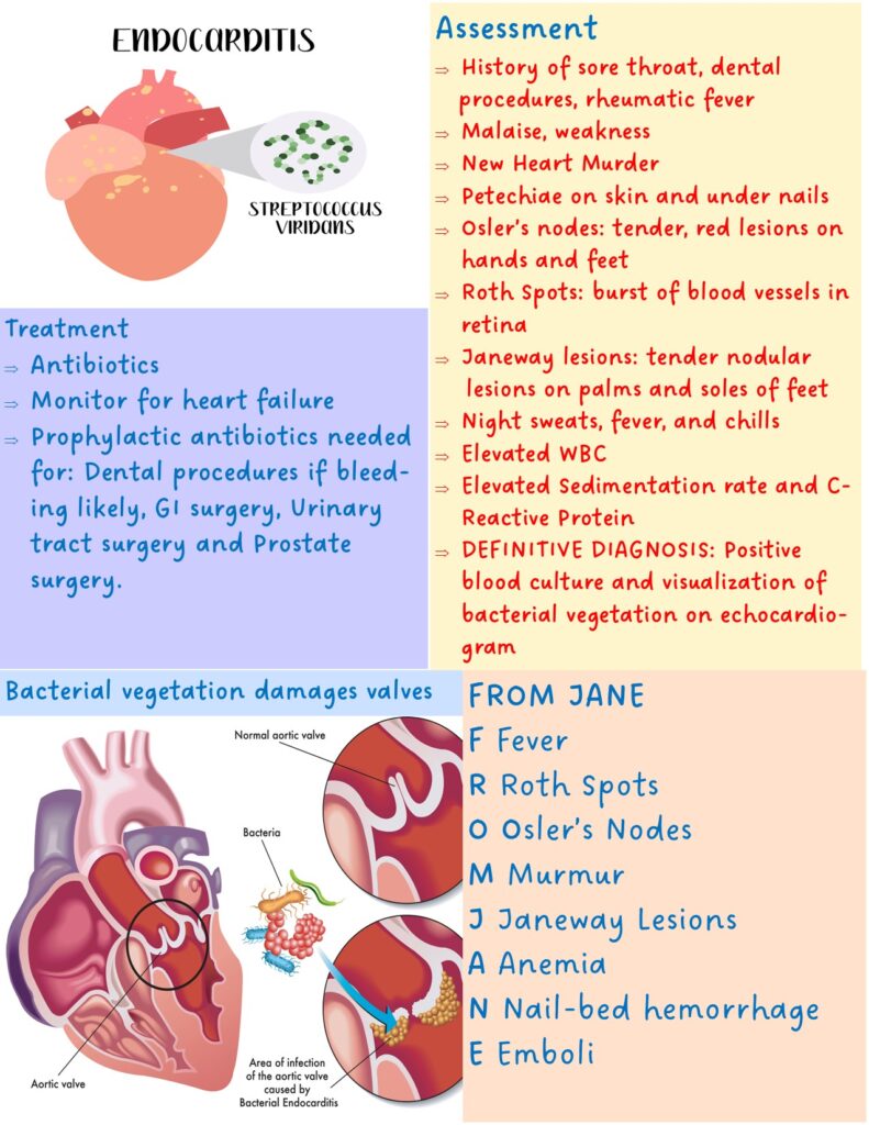 Endocarditis – Illustrated Nursing