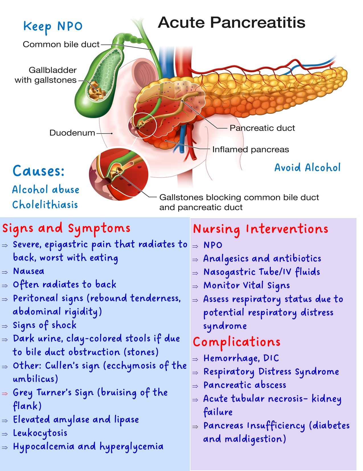 Pancreatitis – Illustrated Nursing