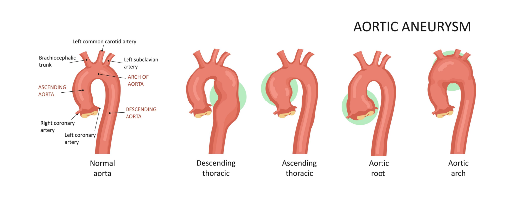 How Much Is 8 Cm Dilated