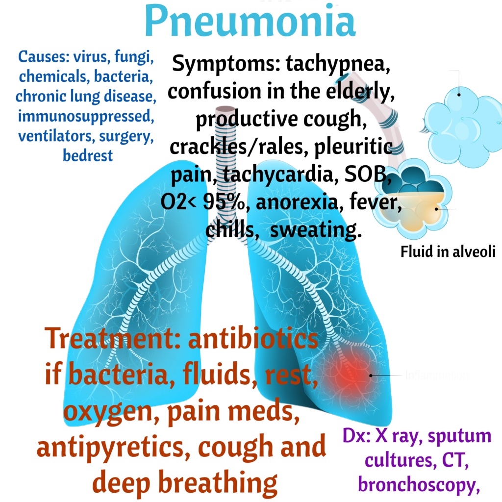 Pneumonia – Illustrated Nursing