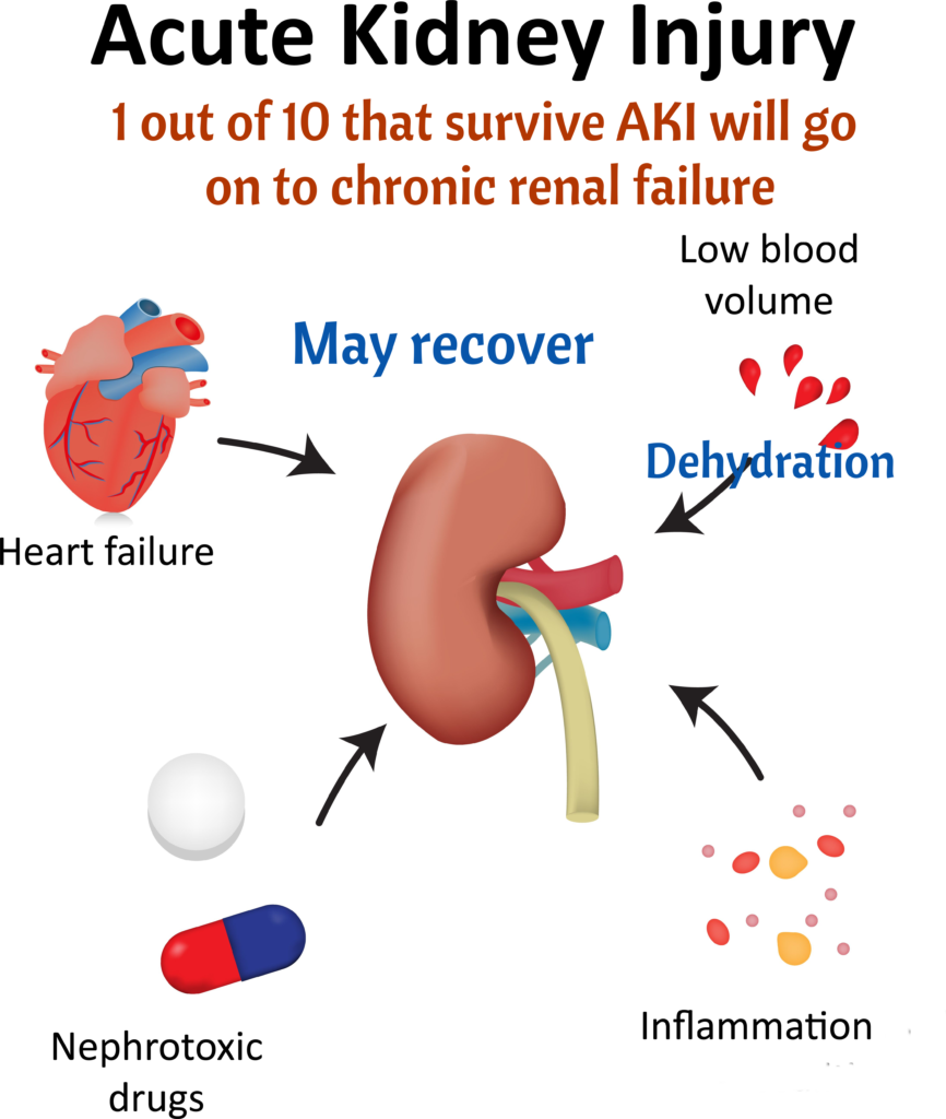 types-of-kidney-failure-illustrated-nursing